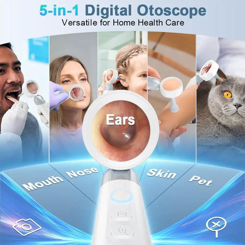 Otoscope Ear Camera With Light And Built In One Point Four Inch HD Screen Plug And Play Ear Scope For Quick No Fuss Home Checks 1080P Clarity USB PC Compatible No Apps Needed For Viewing, 5-in-1 digital otoscope for ears, nose, mouth, skin and pet checks