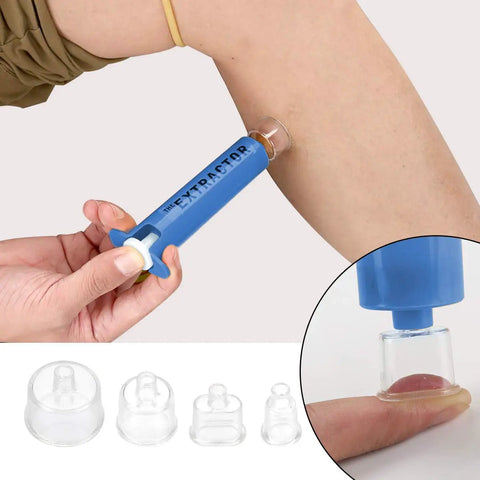 Using Go To Outdoor Bite And Sting Suction Kit for Hiking and Camping Venom Extractor Pump on arm with suction cups