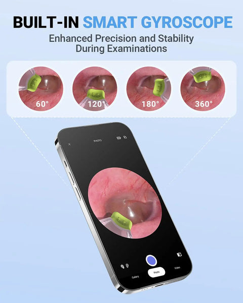 Ultra Thin 3.9mm Ear Otoscope Camera With Light For HD Ear Inspection At Home Kid And Adult Friendly Movement Sensitive Clear Inside View Safe Easy Peasy Ear Checks And Ear Health Tool on smartphone display