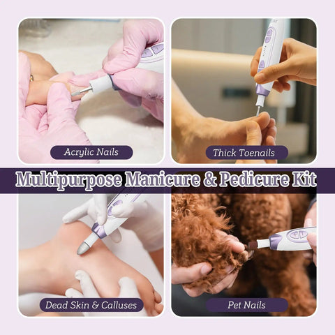 Cordless Electric Foot File For Crusty Thick Toenails And Hard Calluses Packs Eight Swappable Carving Heads Plus Rugged Sanding Collars For No Sweat Salon Ready Pedicure Results in use on thick toenails and pet nails.